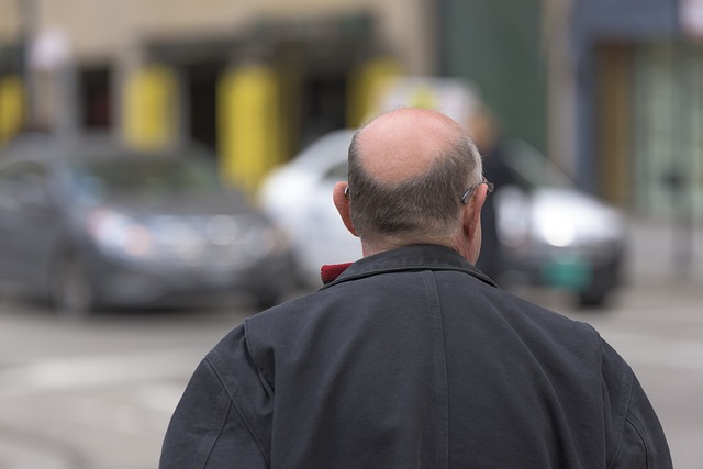 paca préoccupées par la calvitie